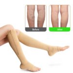 ⁦Zip Socks chaussettes de compression pour les varices⁩ - الصورة ⁦3⁩