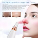 ⁦Aspirateur De Graisse De Visage Performant⁩ - الصورة ⁦4⁩
