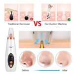 ⁦Aspirateur De Graisse De Visage Performant⁩ - الصورة ⁦5⁩