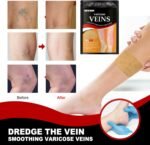 Patchs Herbales Anti-Varices Soulagement Douleur, Amélioration Circulation 12Pcs - لاصقات الأعشاب الطبيعية لعلاج الدوالي والدورة الدموية
